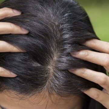خلطة الملح لعلاج شيب الشعر نهائيا وللابد بدون رجوعة مرة أخرى