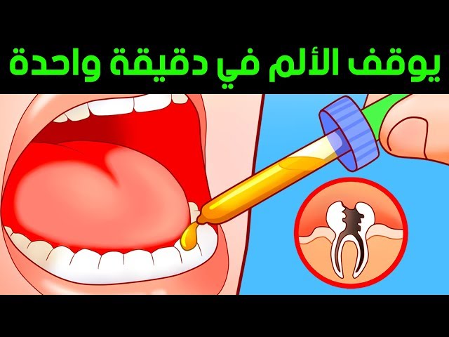 طرق لتخفيف آلام الأسنان في دقيقة واحدة تخلص من آلام أسنانك