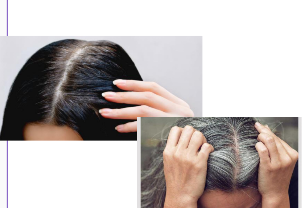 طريقة التخلص من شيب الشعر بوصفات طبيعية 100%
